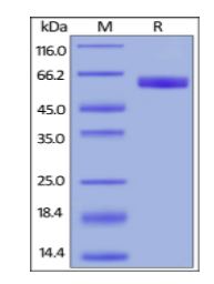 Human CD47, Mouse IgG2a Fc Tag, low endotoxin on SDS-PAGE under reducing (R) and non-reducing (NR) conditions. The gel was stained overnight with Coomassie Blue. The purity of the protein is greater than 95%.